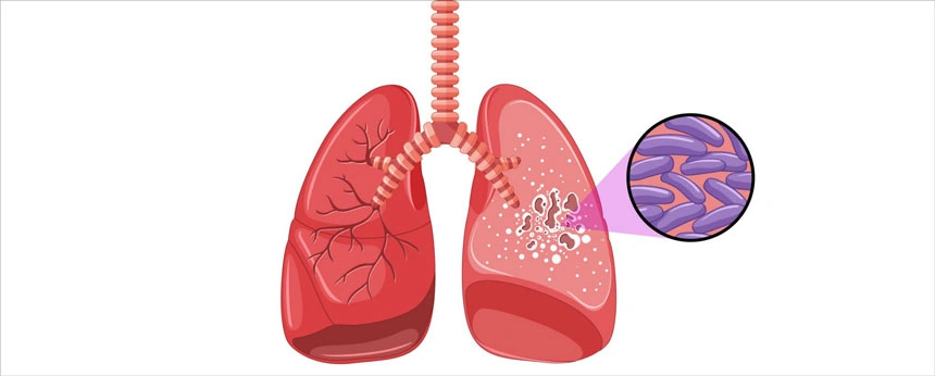 tuberculosis-animals-3